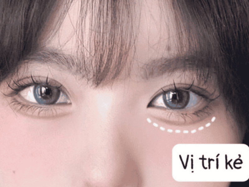 Giải Mã "Aegyo Sal" - Bọng Mắt Đáng Yêu Không Phải Là Khuyết Điểm