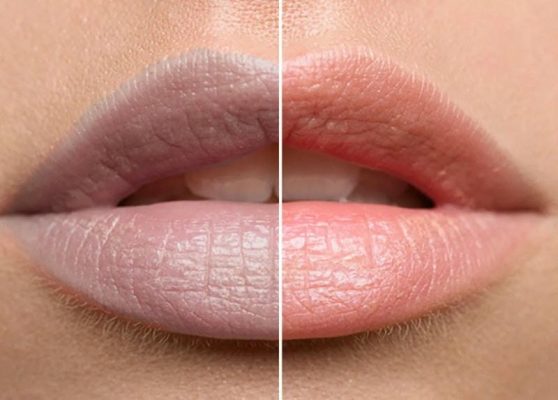 "Bắt Mạch" Nguyên Nhân Khiến Môi Thâm Sạm