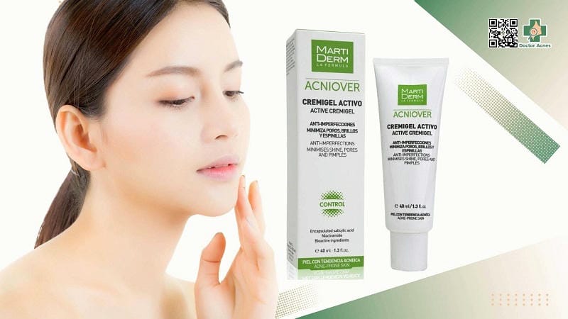 Cẩm Nang Lựa Chọn Kem Dưỡng Ẩm Cho Da Dầu Mụn