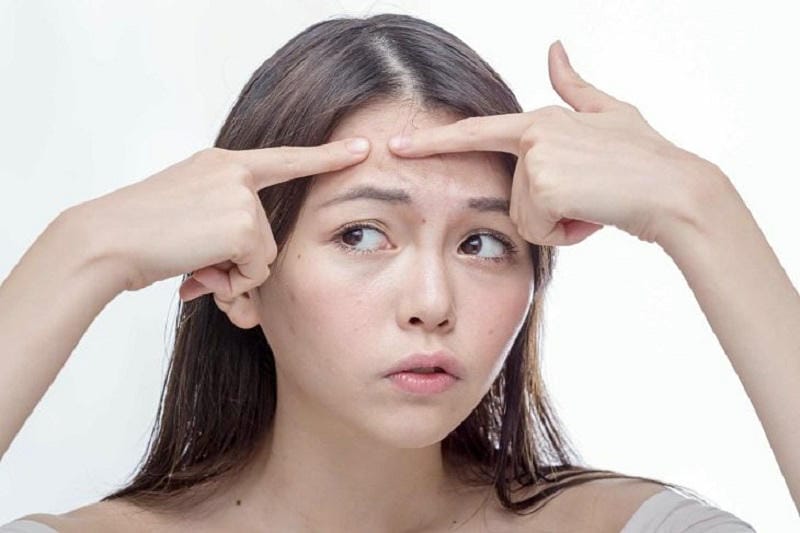 Thay đổi lối sống - "Đồng minh" thầm lặng trong cuộc chiến trị mụn