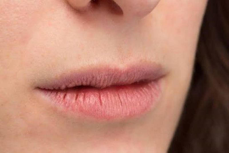 Nha đam, dầu dừa hay mật ong là giải pháp dưỡng môi khô nứt nẻ dịu nhẹ và vô cùng tiết kiệm.