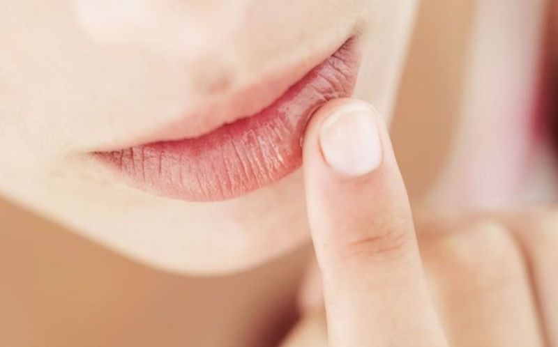 Đôi môi khô nứt nẻ hoàn toàn có thể trở nên mềm mịn nếu áp dụng đúng quy trình chăm sóc tại nhà.