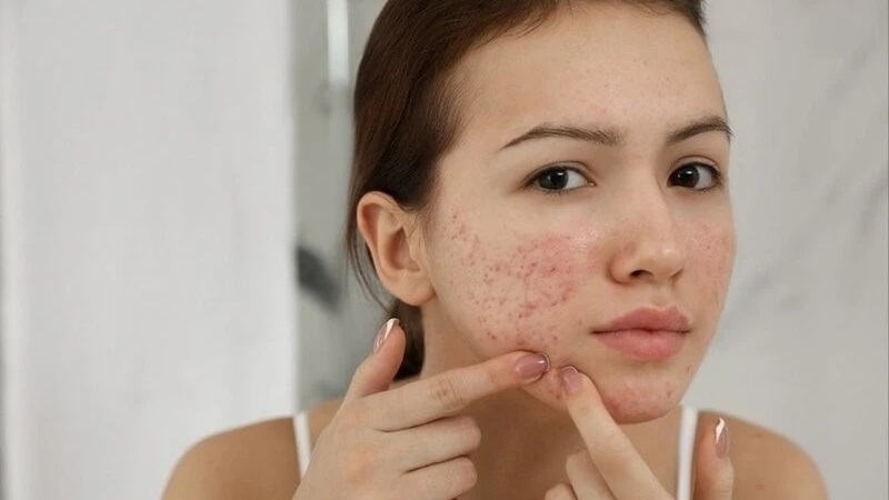 Chọn lựa sản phẩm tối giản, lành tính là chìa khóa giúp khôi phục hàng rào bảo vệ da.
